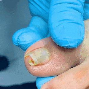 Nails Repair Serum - Growth Nails – Dealcarto