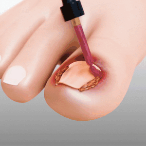 Nails Repair Serum - Growth Nails